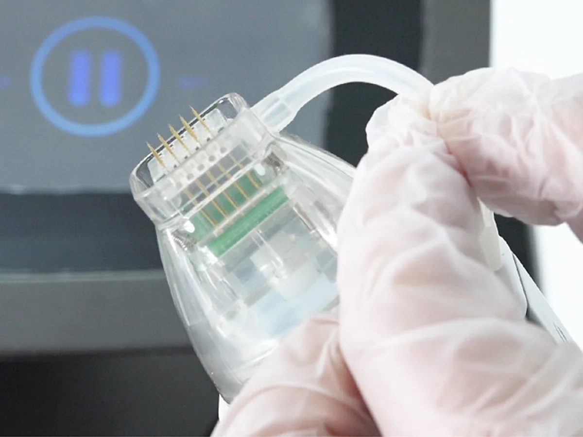 ADSS Микроигольчатый RF — фото 5